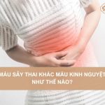 Mau-say-thai-khac-mau-kinh-nguyet-nhu-the-nao