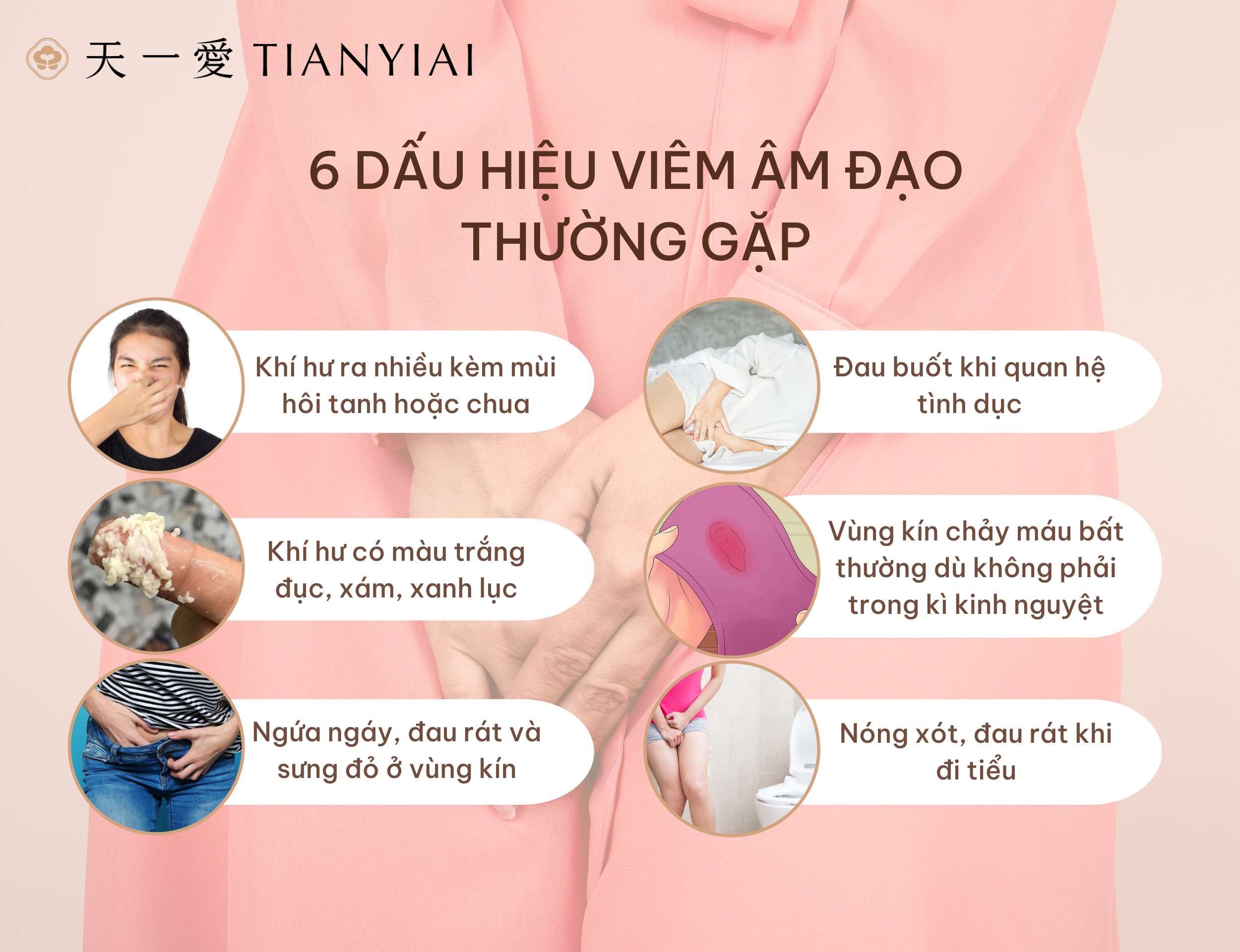 6 dấu hiệu viêm âm đạo:1. Do vi khuẩn 2. Do nấm men 3. Do quan hệ tình dục không an toàn 4. Do viêm không lây nhiễm 5. Do trùng roi Trichomonas 6. Do viêm teo âm đạo 