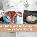 Da-nang-buong-trung-nguyen-nhan-va-cach-dieu-tri