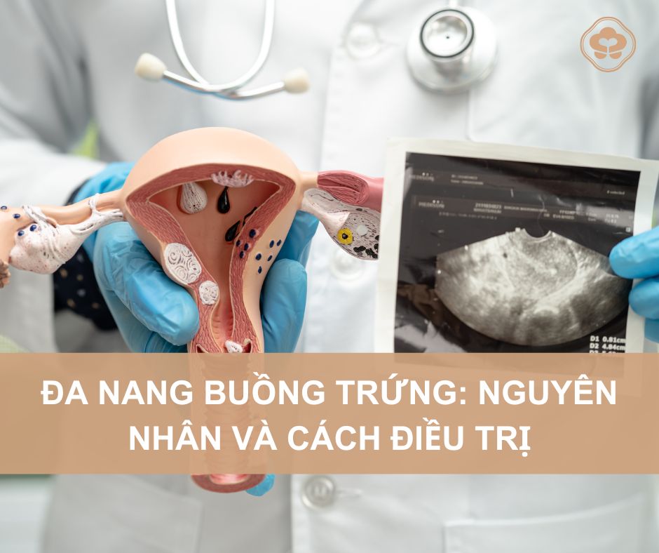 Da-nang-buong-trung-nguyen-nhan-va-cach-dieu-tri