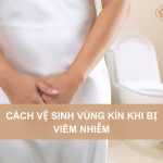 Cach-ve-sinh-vung-kin-khi-bi-viem-nhiem