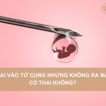 Thai-vao-tu-cung-nhung-khong-ra-mau