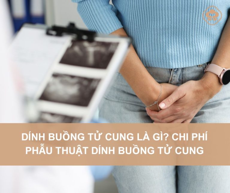 Dinh-buong-tu-cung