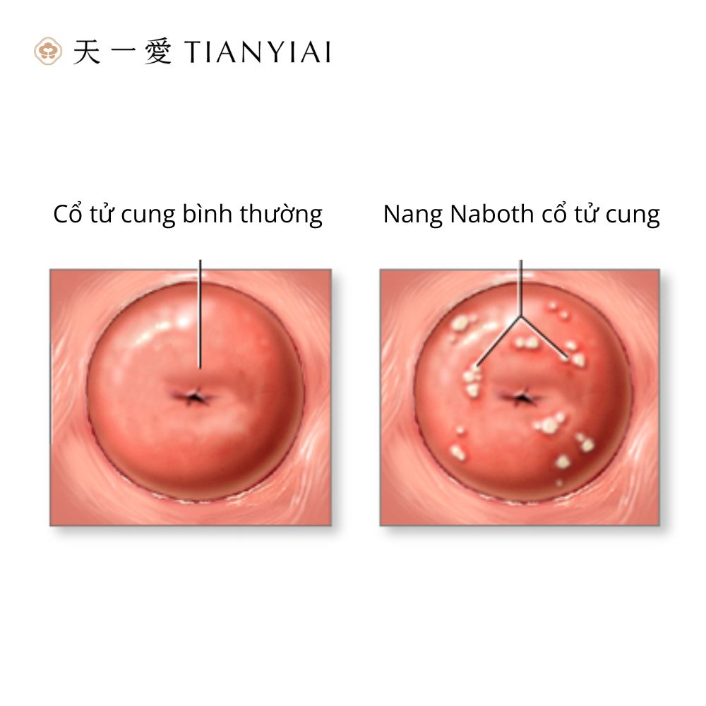 Nang-naboth-co-tu-cung 