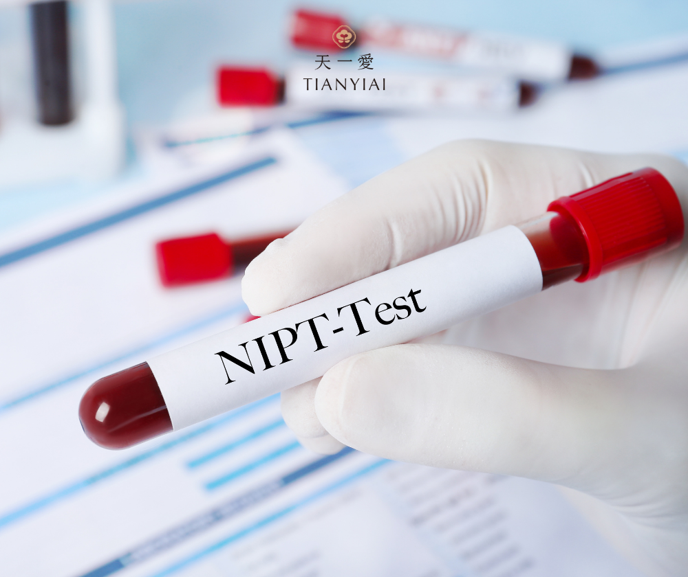 Xét nghiệm NIPT là gì?