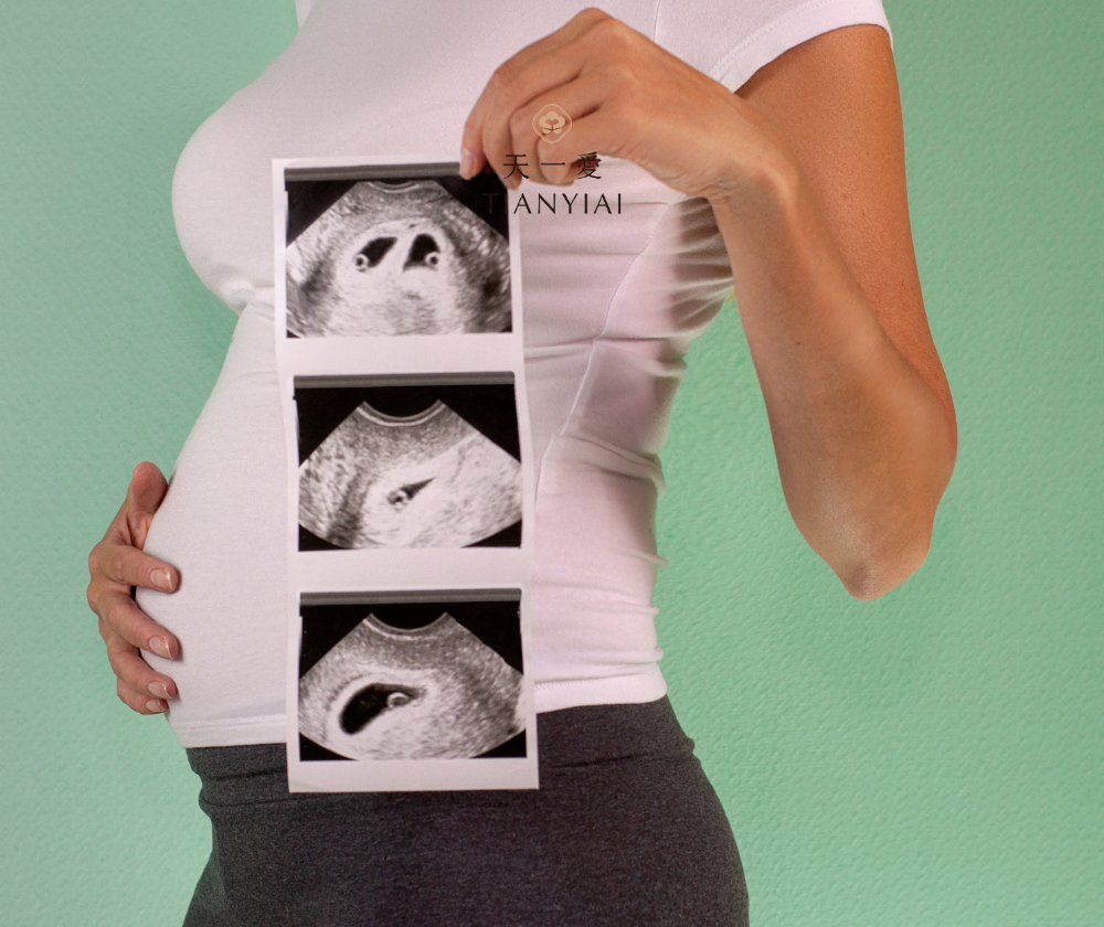 Xét nghiệm NIPT có biết được trai hay gái không?