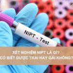 Xét nghiệm NIPT là gì? Có biết được trai hay gái không?