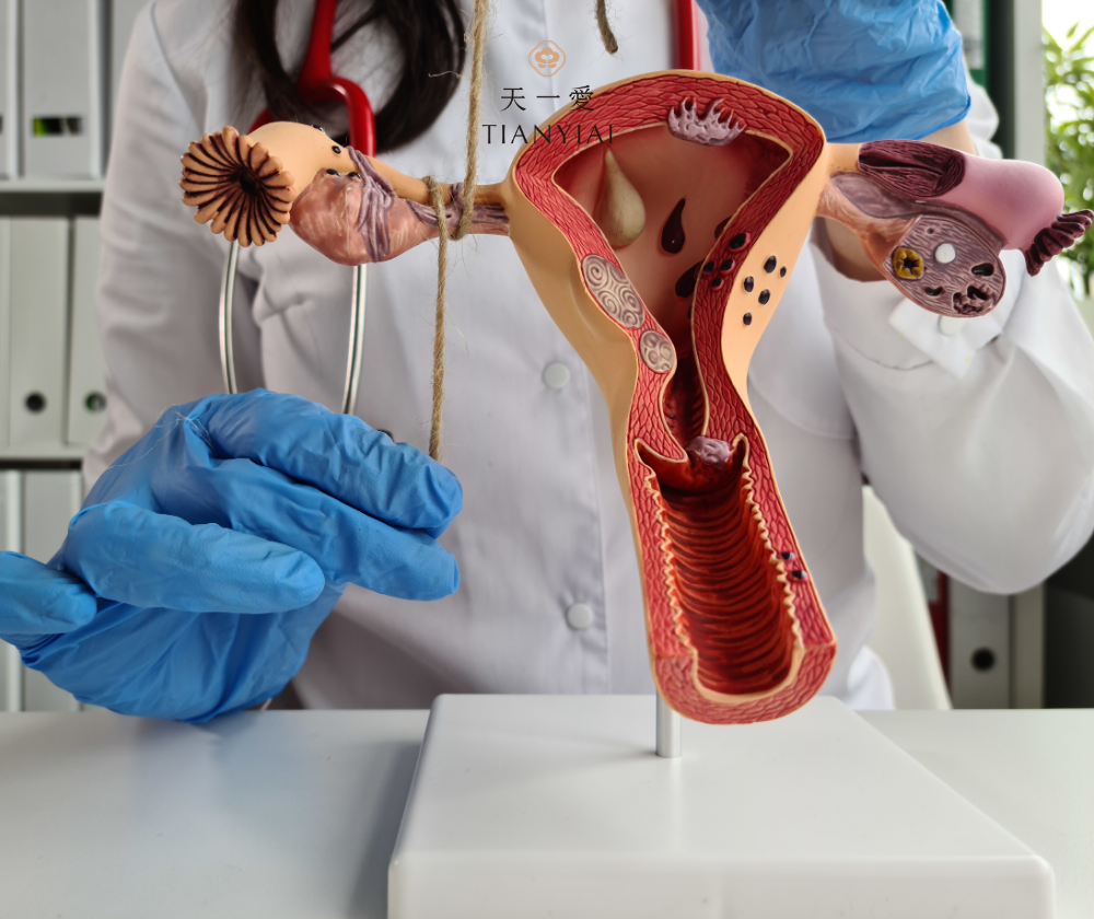 Dấu hiệu tắc vòi trứng